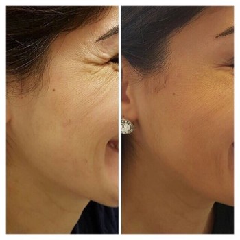 Фото с портфолио Светлана Колесник 