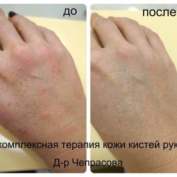 Фото с портфолио Золотой лотос