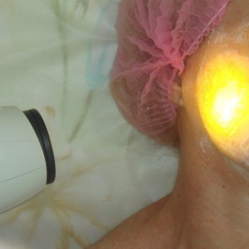 Комбинированная чистка кожи лица и тела
                    Косметолог Татьяна Прилепа Запорожье