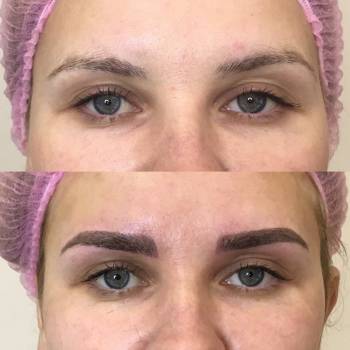 Одеяло, Харків Фото - 5