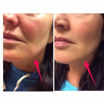 Фото с портфолио Светлана Колесник 