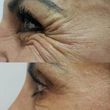 Фото с портфолио Светлана Колесник 