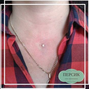 Персик, Запорожье Фото - 10