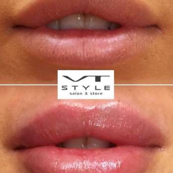 VT Style, Херсон Фото - 8