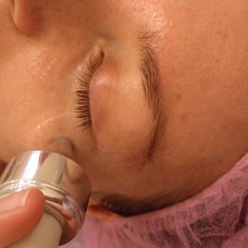 УЗ-фонофорез