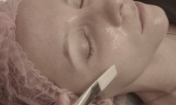 Химический пилинг Салон красоты Абсолютно новая жизнь Запорожье