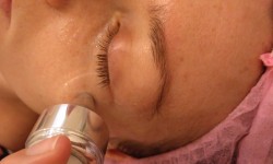 Ультразвуковой фонофорез Салон красоты Абсолютно новая жизнь Запорожье