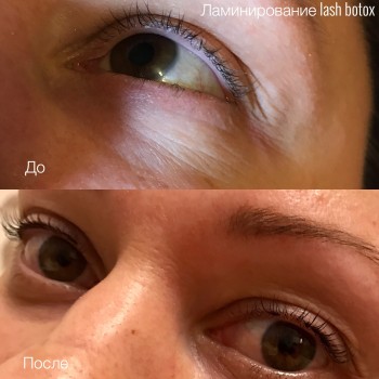 Ламинирование ресниц
                    Лешмейкер Шилина Елена Київ