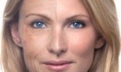 Биоревитализация Косметолог Лилия Дычка Київ