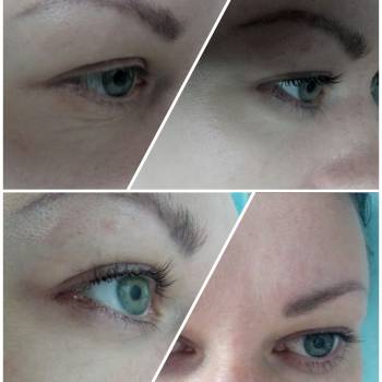 Ламинирование ремниц