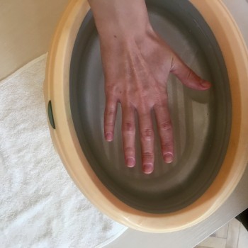 Парафинотерапия