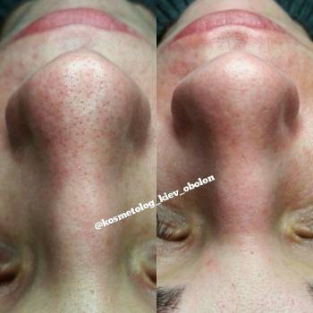 Алина Батлер , Киев Фото - 5