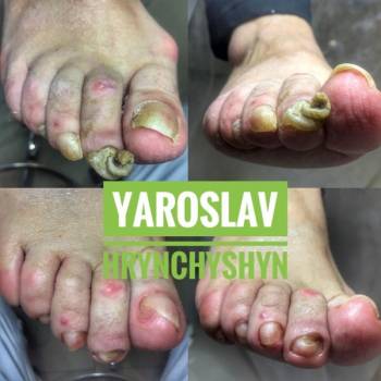 Ярослав Гринчишин, Львів Фото - 10