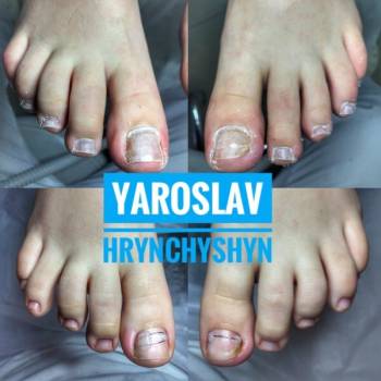 Ярослав Гринчишин, Львів Фото - 11