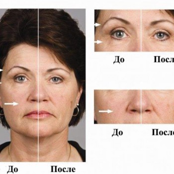 Микротоковая терапия
                    Косметолог-инъекционист Наталия Одесса