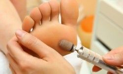 Подология: Медицинский педикюр для дам Косметологическая клиника МЕД косметология Київ