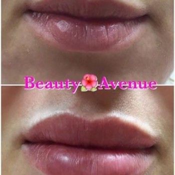 Збільшення губ оформлення брів нарощеннявій, фото -  Beauty Avenue