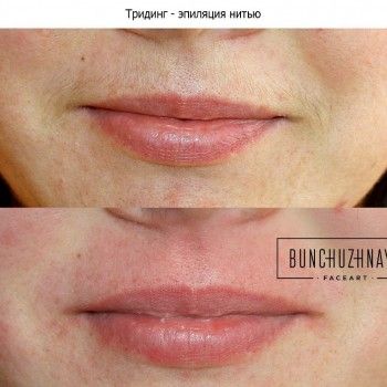 Тридинг - коррекция бровей нитью
                    Салон красоты Bunchuzhnaya FaceArt Київ