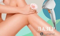 Лазерная эпиляция: ноги полностью Медико-косметологический центр Excellence Київ