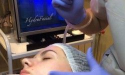 Чистка HydraFacial™ anti-age boutique LYS ROYAL Киев