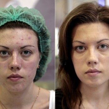 Фото с портфолио Делекос