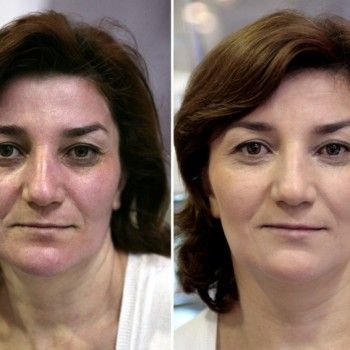 Фото с портфолио Делекос