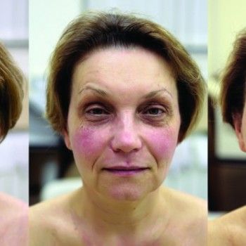 Фото с портфолио Делекос