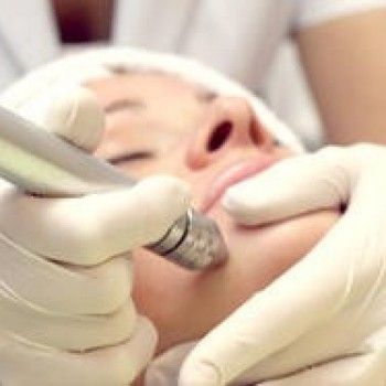 Микродермабразия лица
                    Салон красоты Золотая рыбка Киев