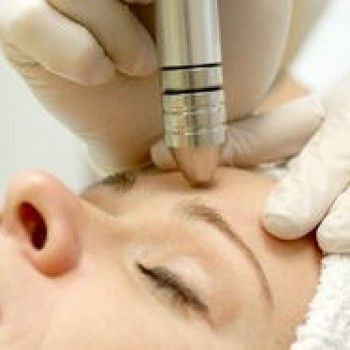 Микродермабразия лица
                    Салон красоты Золотая рыбка Киев