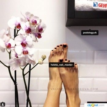 Подология: Удаление вросшего ногтя
                     Студия Валентины Кадыровой Киев