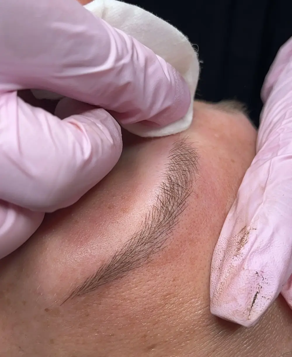 Фото процесу проведення мікроблейдингу