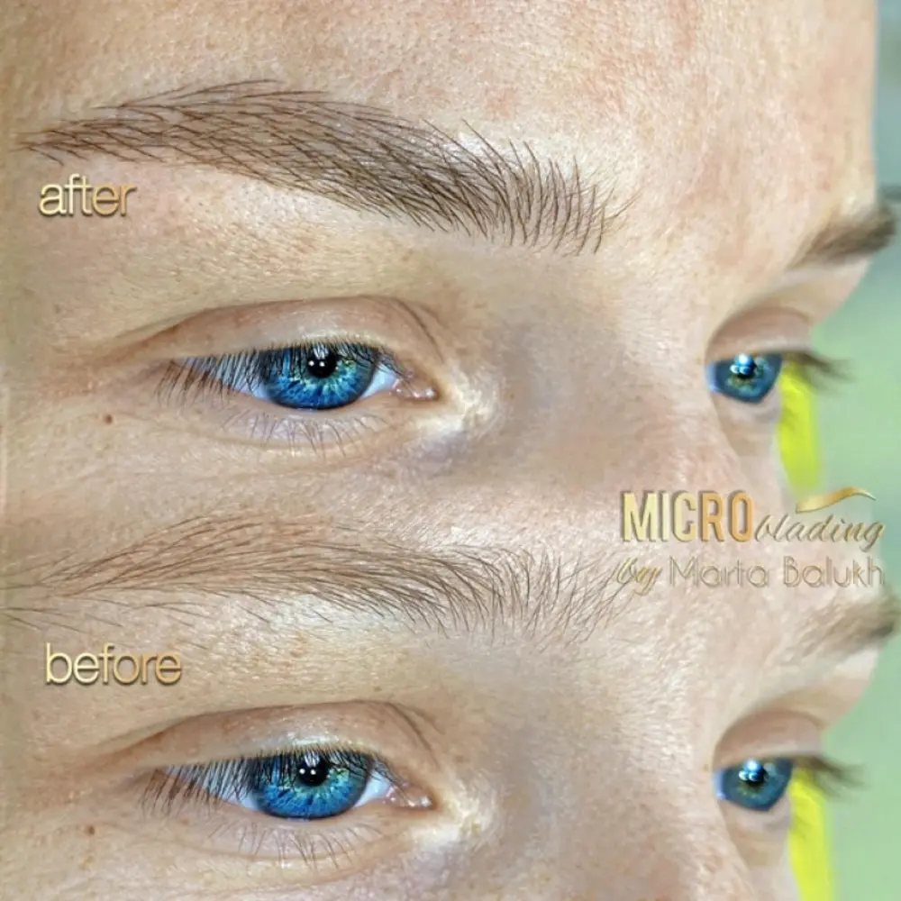Фото до та після проведення процедури мікроблейдингу брів