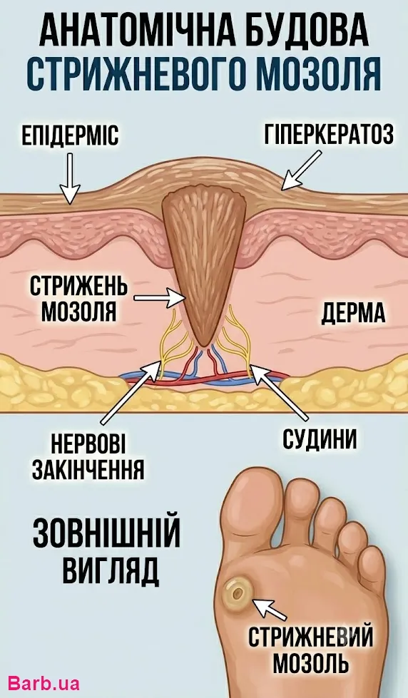 Инфографика: Анатомическое строение стержневой мозоли